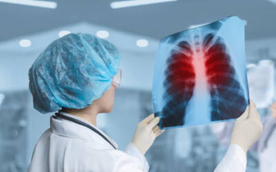 Razotkrivanje tajni zdravlja pluća: ključni simptomi upale pluća