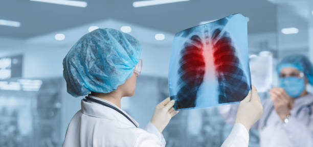 Razotkrivanje tajni zdravlja pluća: ključni simptomi upale pluća