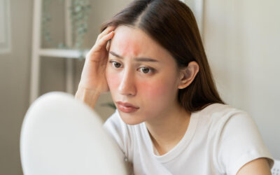 Suočavanje s crvenilom lica: Kako umiriti i njegovati osjetljivu kožu lica