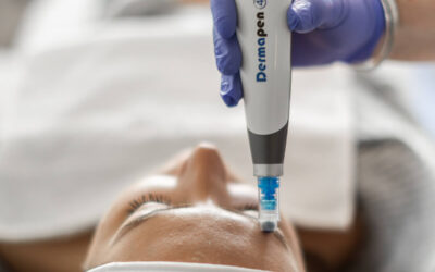 Microneedling cijena tretmana – koliko košta i što utječe na iznos